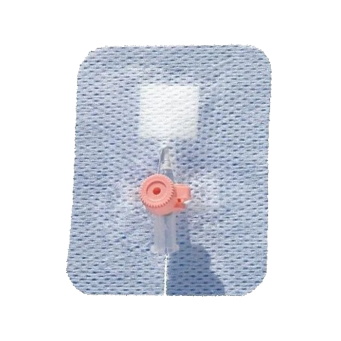 Vecafix, Cathéter De Perfusion Pour Pl¢tre De Fixation 7,5x6cm 50 Pièces 3 Vecafix, Cathéter De Perfusion Pour Pl¢tre De Fixation 7,5x6cm 50 Pièces